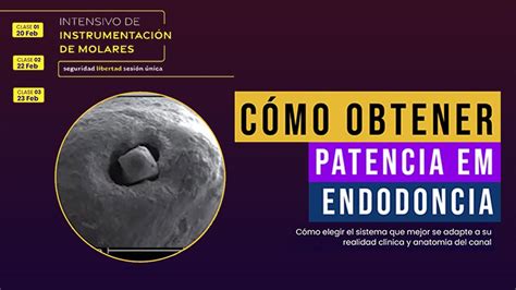 patenesia|patência significado.